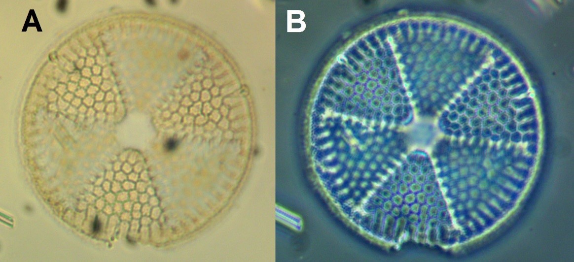 Диатомовая одноклеточная водоросль при микроскопировании